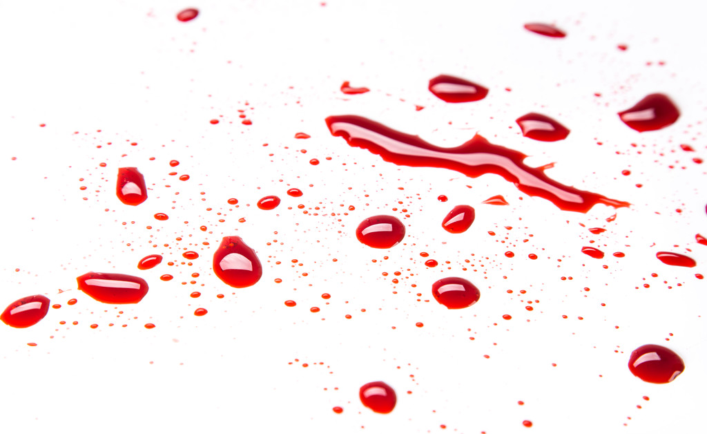 Blutflecken auf weißem Hintergrund - Foto, Bild