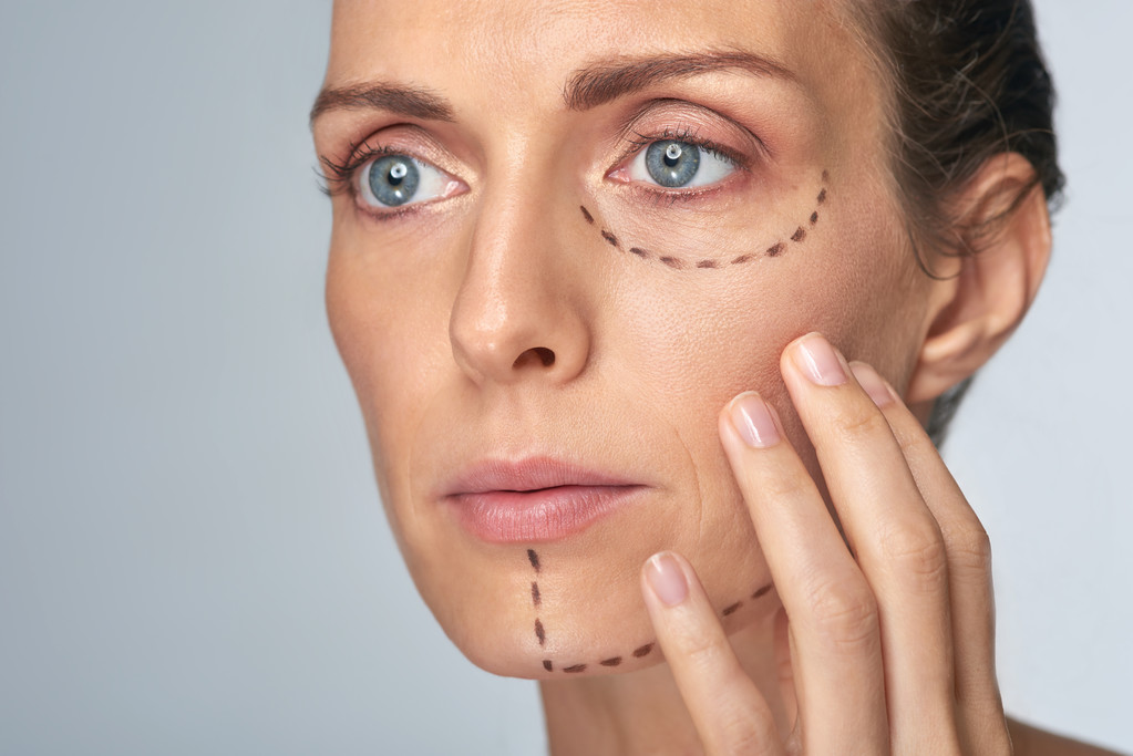 Διάτρηση σχεδίαση γραμμών στο πρόσωπό της γυναίκας πριν από τη διαδικασία - Φωτογραφία, εικόνα