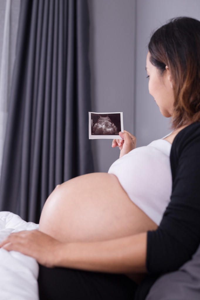 mulher grávida com imagem de ultra-som do bebê sentado na cama em b
 - Foto, Imagem