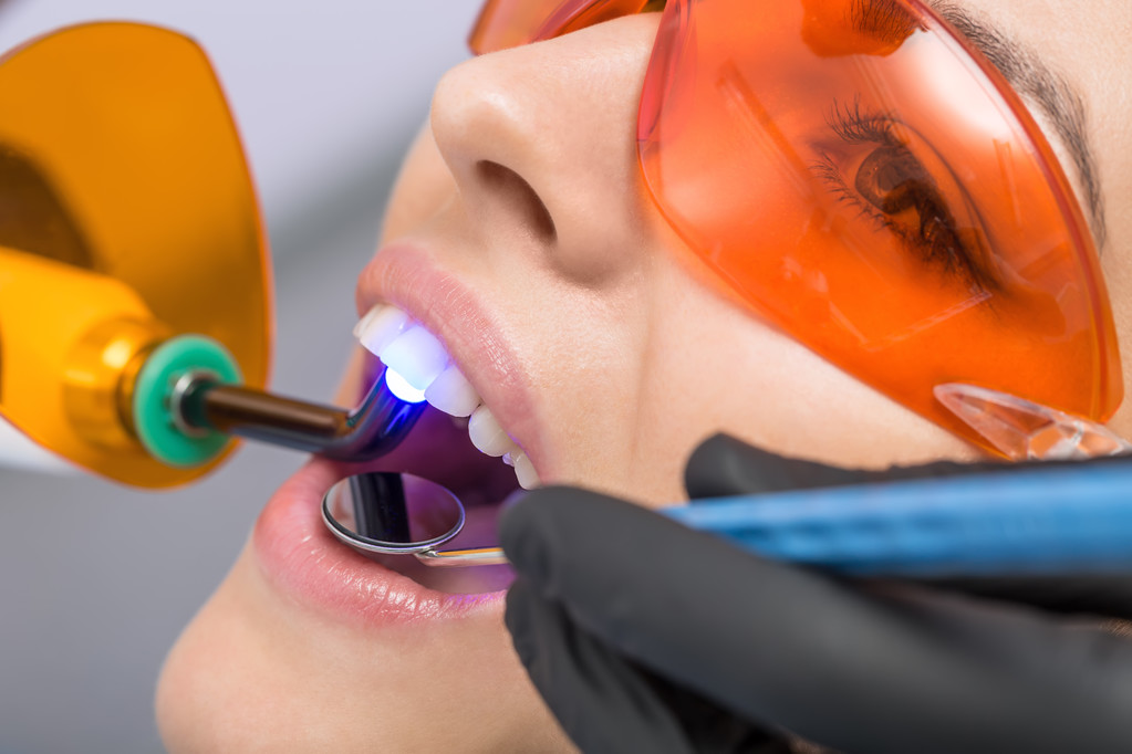 Macro foto van tandheelkundige behandeling - Foto, afbeelding