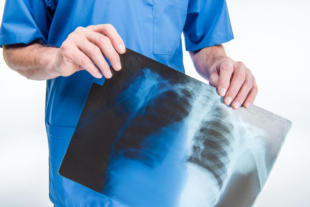 Syrgeon holding x-ray afbeelding - Foto, afbeelding
