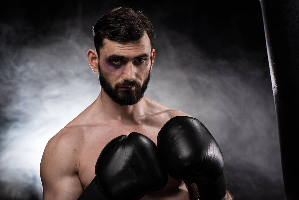 Boxer with black eye - Photo, Image