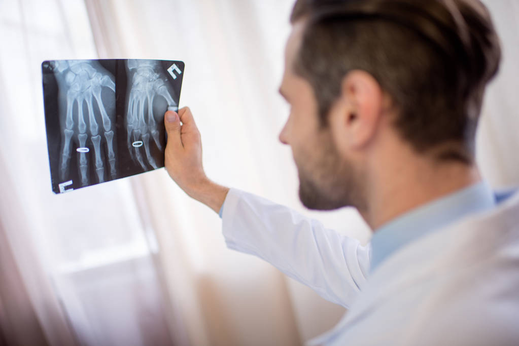 Doctor sosteniendo imagen de rayos X
 - Foto, Imagen