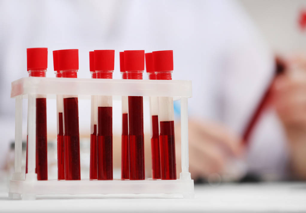 Тестові трубки з зразками крові
 - Фото, зображення