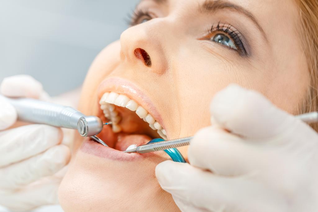 Hasta diş check-up  - Fotoğraf, Görsel