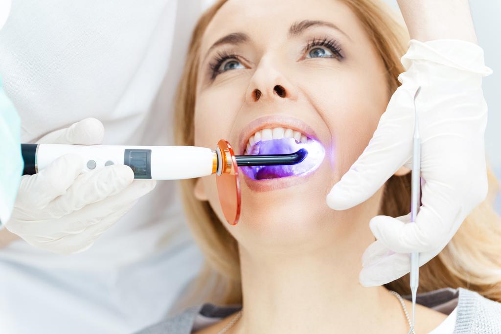Λεύκανση δοντιών ασθενούς στον οδοντίατρο - Φωτογραφία, εικόνα