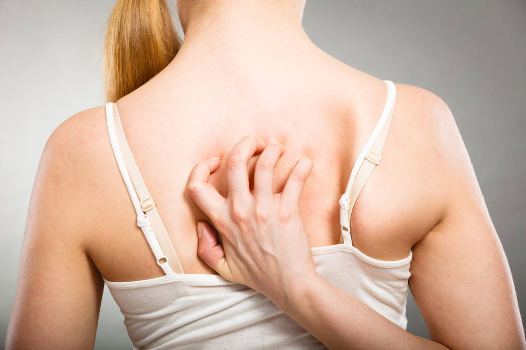 女性アレルギーの発疹のかゆみ背中を掻く - 写真・画像