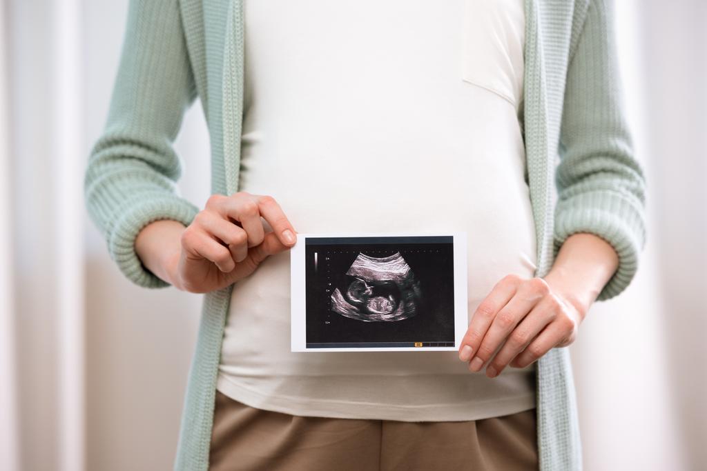 Donna incinta con ecografia del bambino
 - Foto, immagini