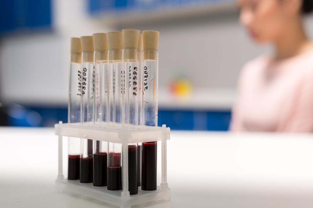 tubos con muestras de análisis de sangre
 - Foto, Imagen