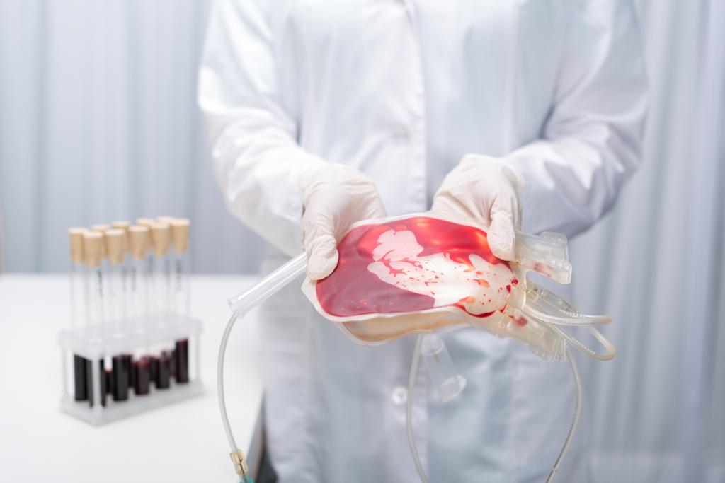 attrezzature mediche per le trasfusioni di sangue
 - Foto, immagini