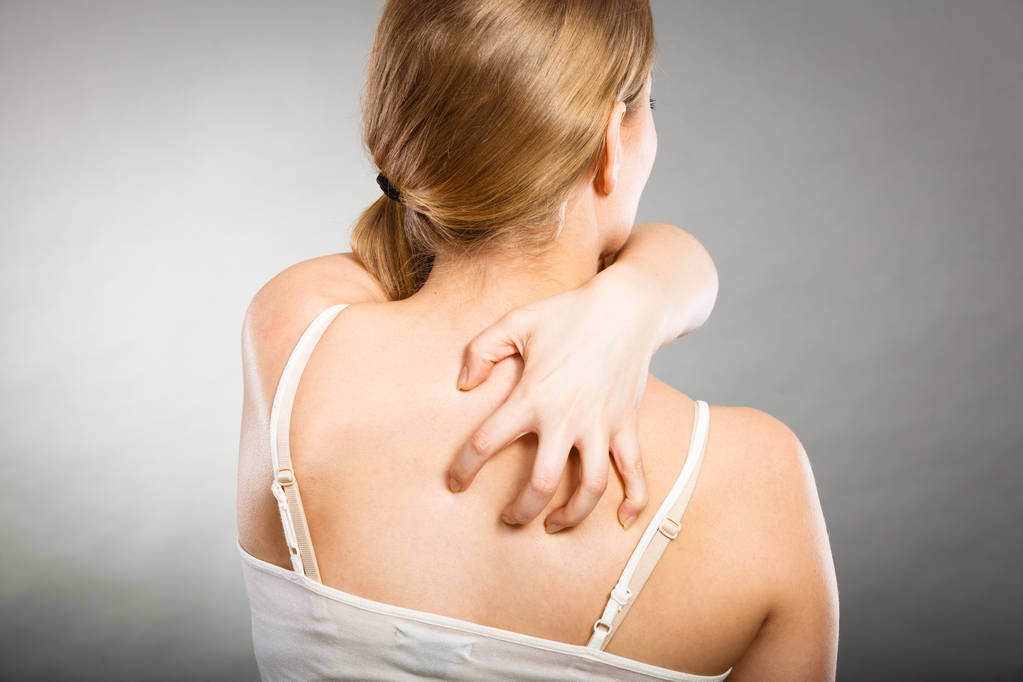 女性アレルギーの発疹のかゆみ背中を掻く - 写真・画像