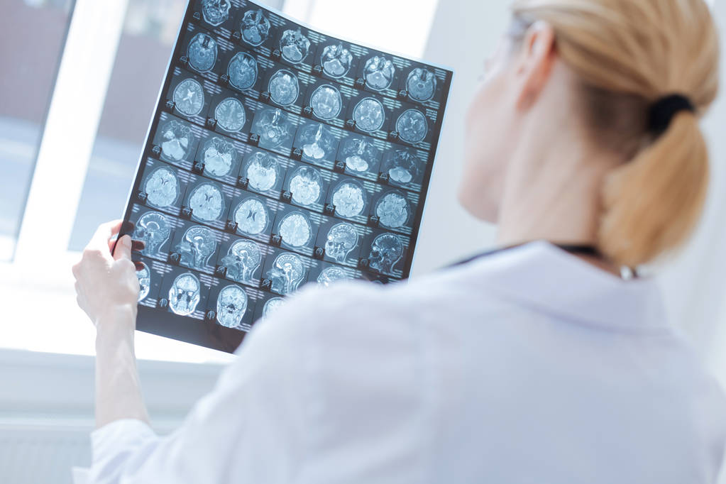 Laboratuvar, röntgen beyin sonuçları inceleyerek ilgili beyin cerrahı - Fotoğraf, Görsel