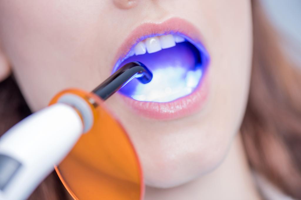 pacienta a zubního lékařství, léčení světlem - Fotografie, Obrázek