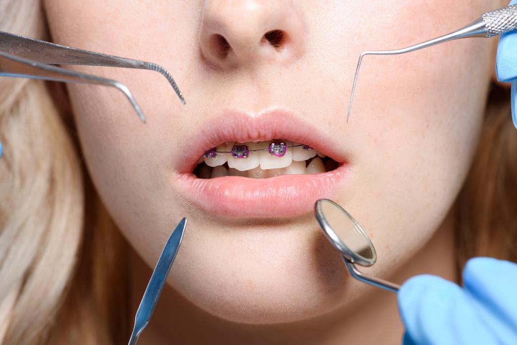  herramientas del dentista
  - Foto, Imagen