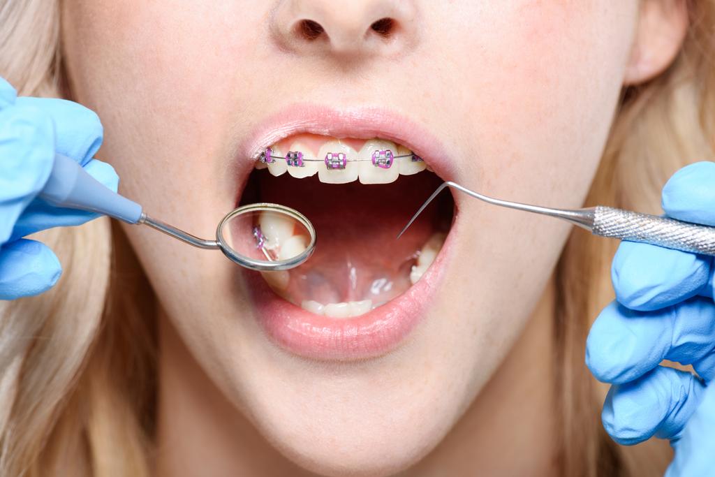Dentiste utilisant miroir et sonde parodontale
 - Photo, image