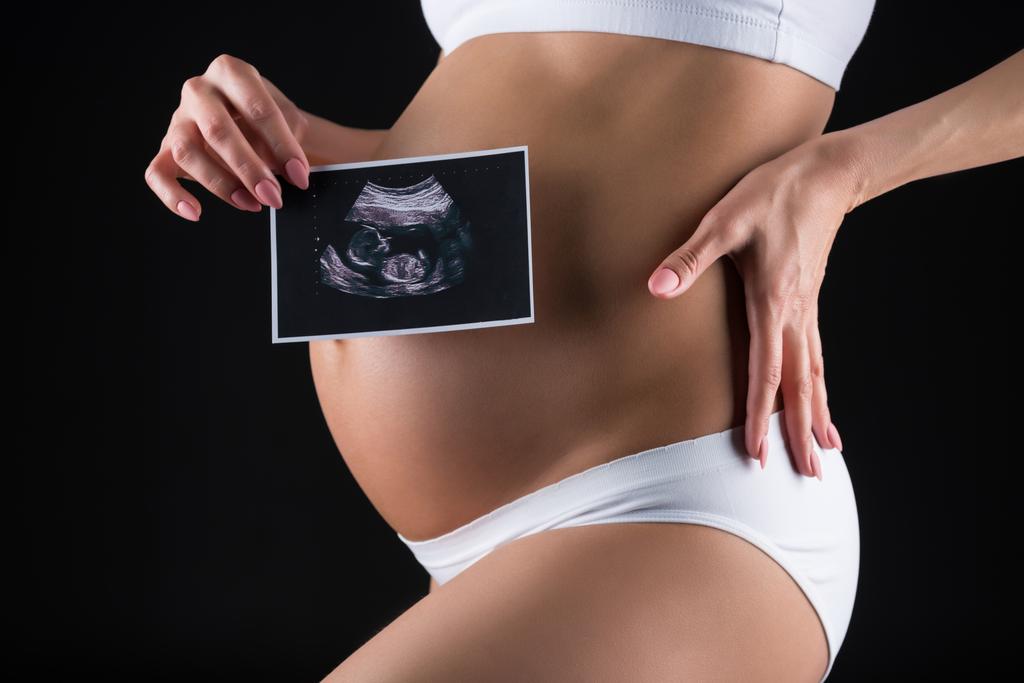 Raskaana oleva nainen, jolla on ultraääni - Valokuva, kuva