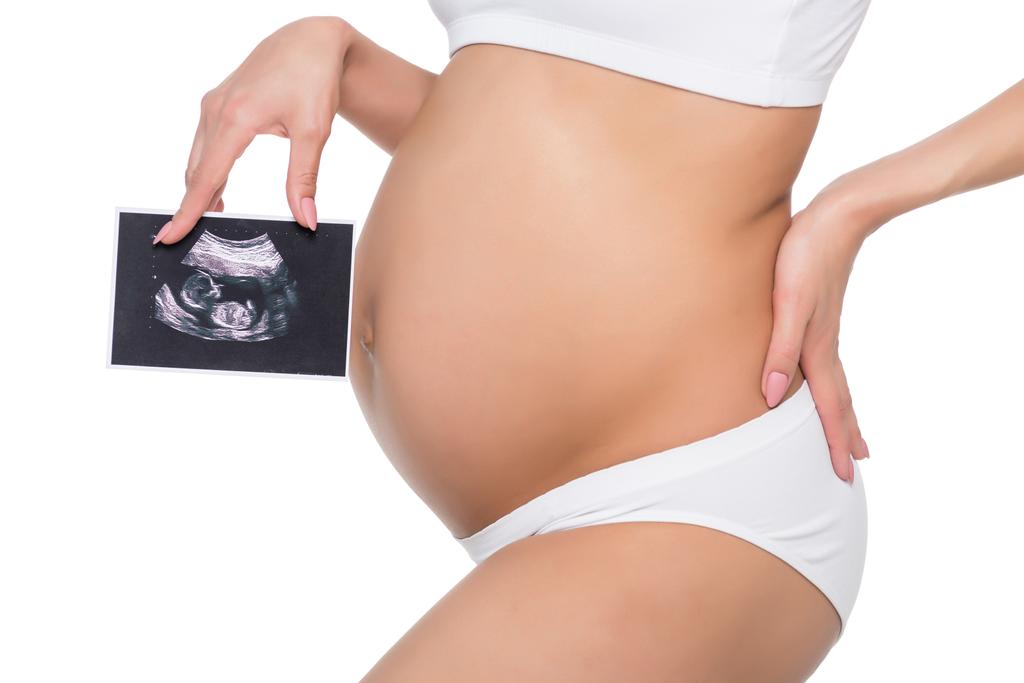 Έγκυος γυναίκα με υπερηχογράφημα - Φωτογραφία, εικόνα