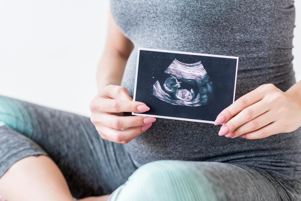 Terhes nő ultrahang vizsgálattal - Fotó, kép