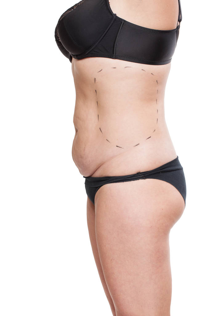 Gordinha corpo feminino forrado com marcador
 - Foto, Imagem