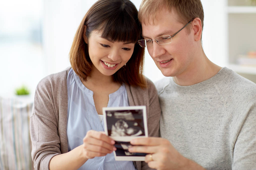 primer plano de pareja feliz con ultrasonido de bebé
 - Foto, imagen