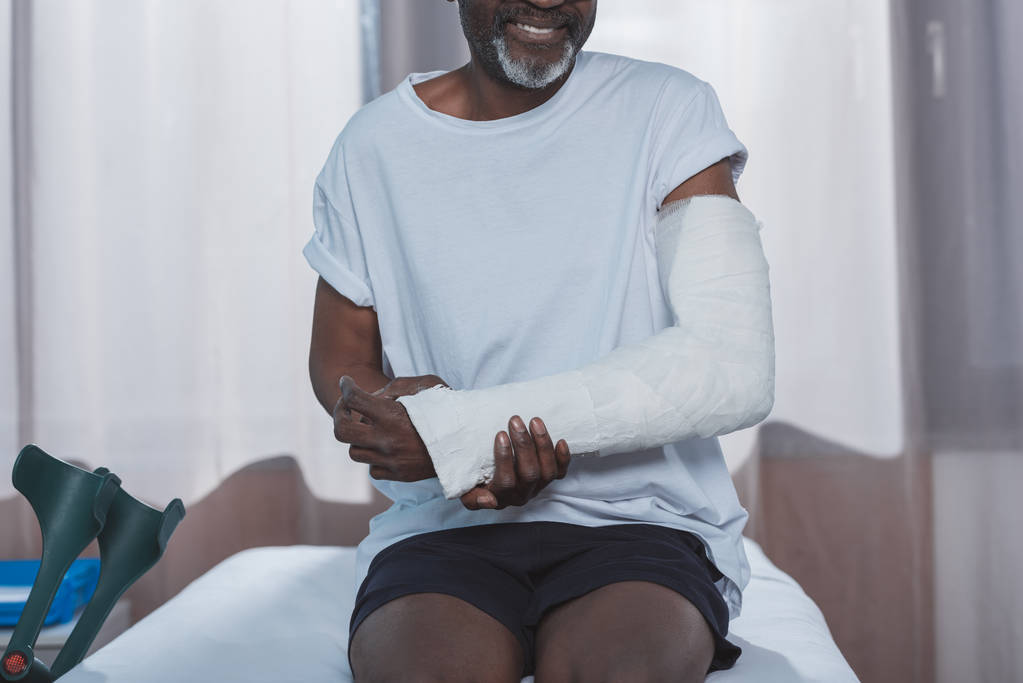 Paziente con braccio rotto
 - Foto, immagini