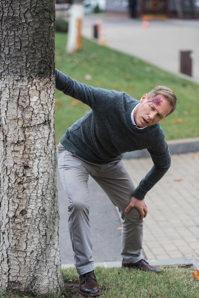 τραυματίες μέσης ηλικίας άνθρωπο με τραύμα στο κεφάλι που γέρνει πάνω σε δέντρο στο δρόμο - Φωτογραφία, εικόνα