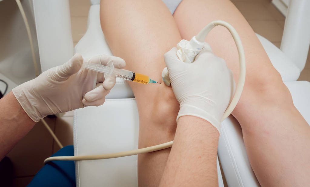 Injection plasmatique du genou guidée par ultrasons et riche en plaquettes - Photo, image