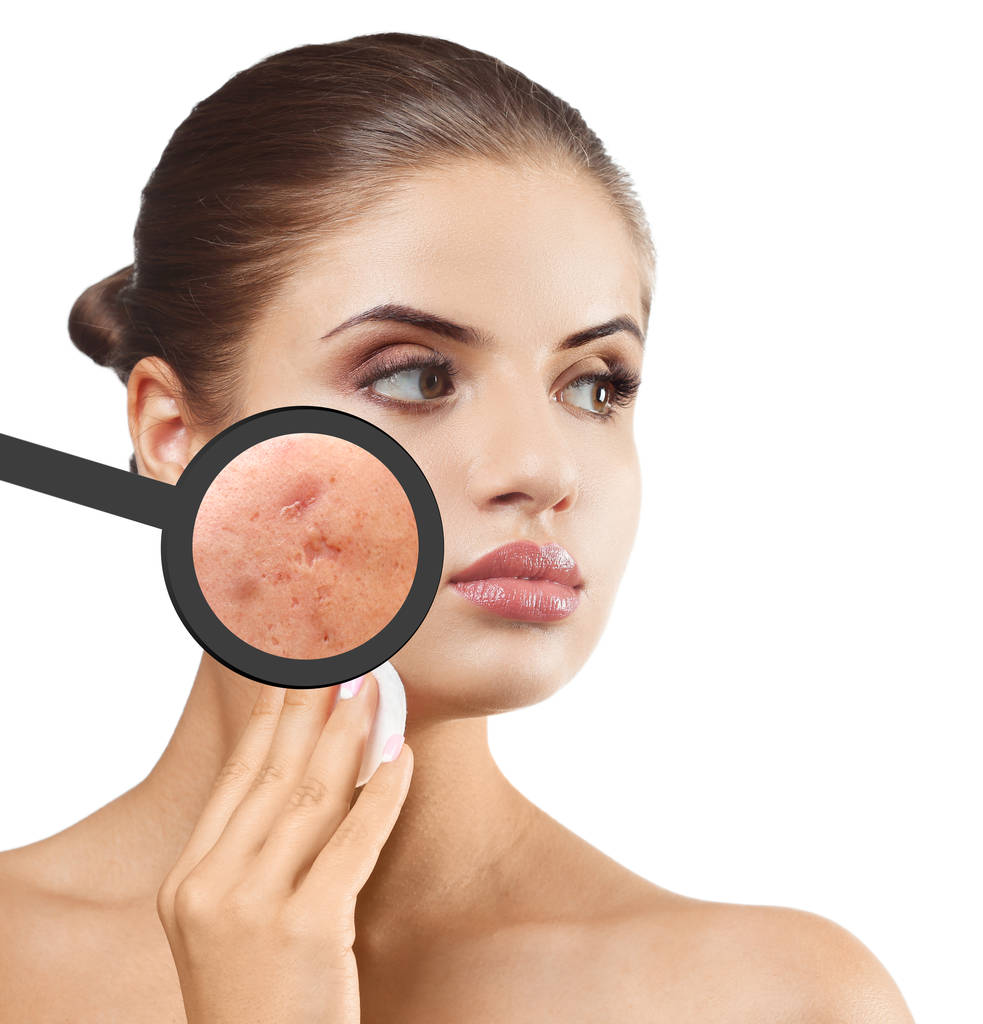 Mladá žena s lupou ukazující akné na obličeji proti bílým pozadím - Fotografie, Obrázek