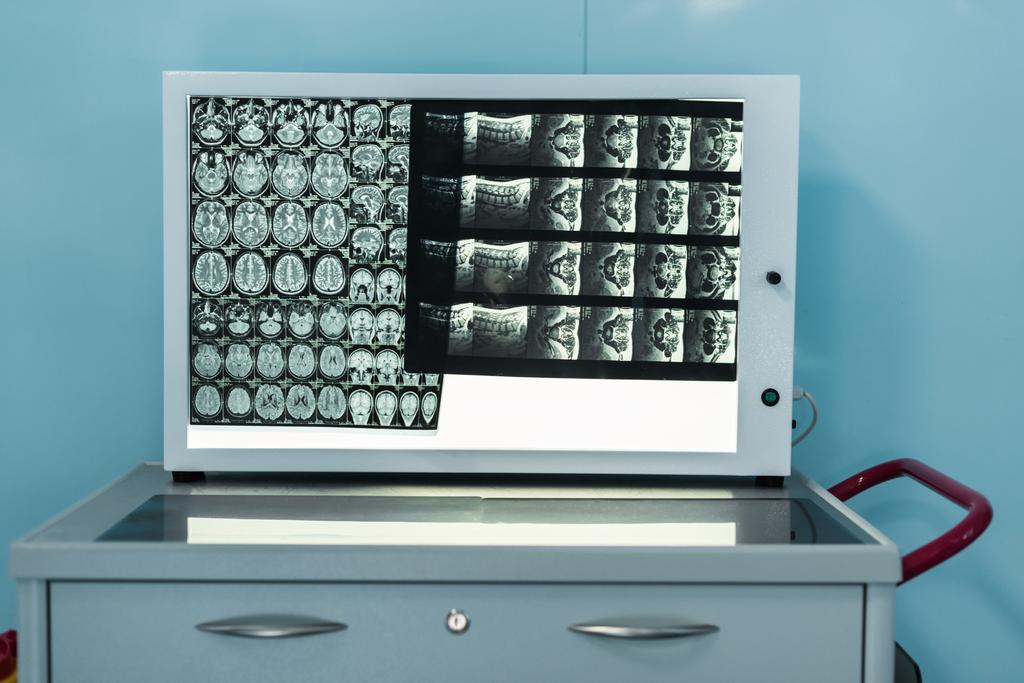 medical screen with x-ray in modern hospital - Photo, Image
