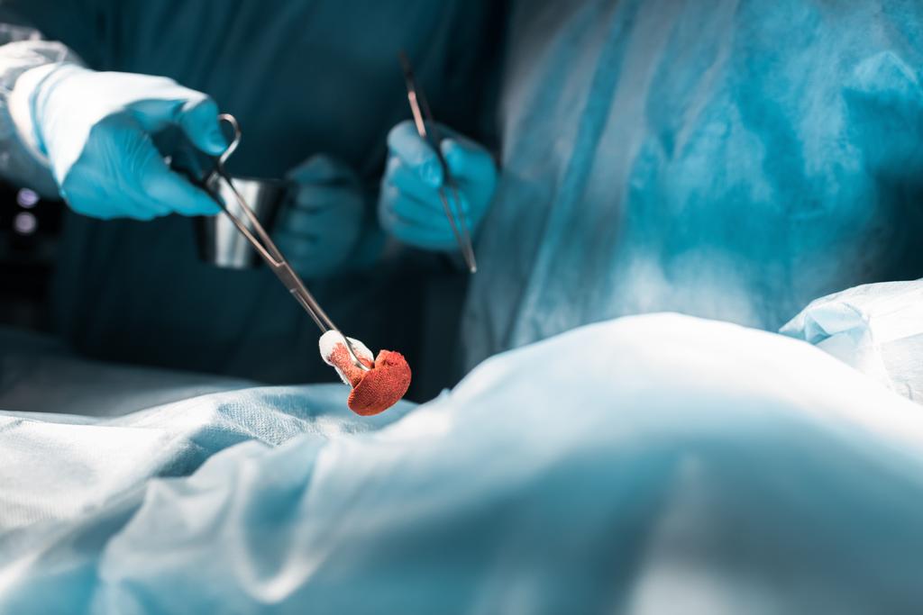 περικομμένη εικόνα των χειρουργών κρατώντας Χειρουργικές λαβίδες - Φωτογραφία, εικόνα