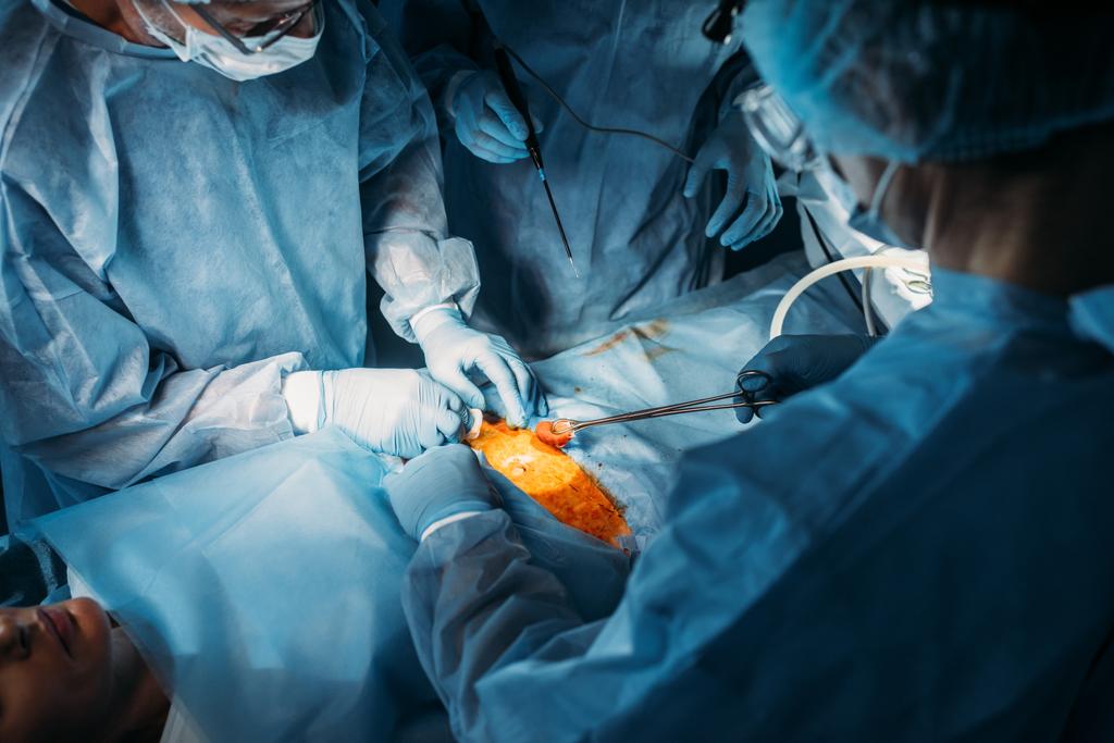 rajattu kuva kirurgit toimivat potilaan leikkaussalissa
 - Valokuva, kuva
