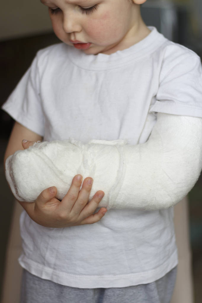 the boy broke his arm - Photo, Image