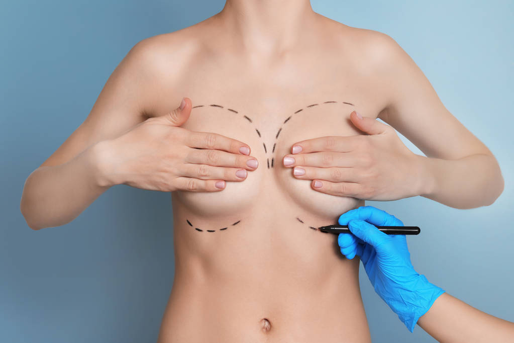 Doctor drawing marks on female breast for cosmetic surgery operation against color background - Photo, Image