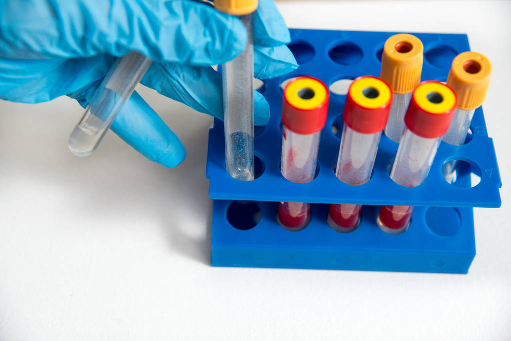 El médico o asistente de laboratorio toma tubos de ensayo médicos de vidrio, en un guante azul, un trípode azul en el fondo. sobre un fondo blanco
 - Foto, Imagen