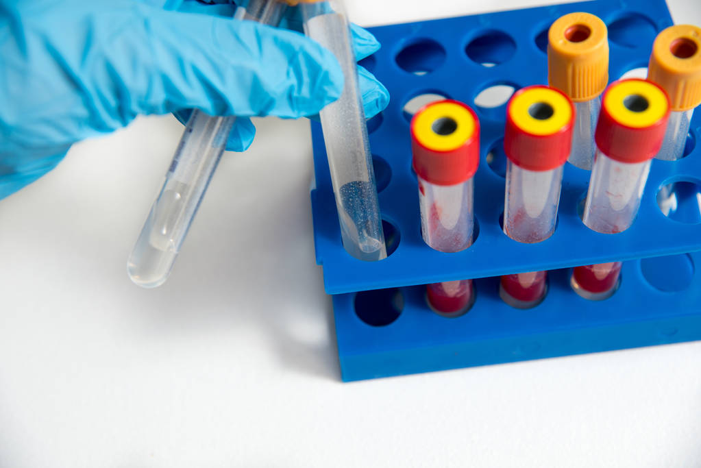 O médico ou assistente de laboratório leva tubos de ensaio médico de vidro, em uma luva azul, um tripé azul no fundo. sobre um fundo branco
 - Foto, Imagem