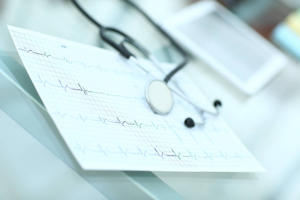 stéthoscope et cardiogramme sur une table médicale
 - Photo, image