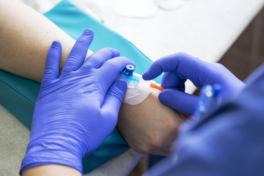 Krankenschwester mit blauen Latex-Handschuhen bringt Katheter zu Venenpatientin, um Chemotherapie oder ein anderes flüssiges Medikament gegen Krebs zu erhalten - Foto, Bild