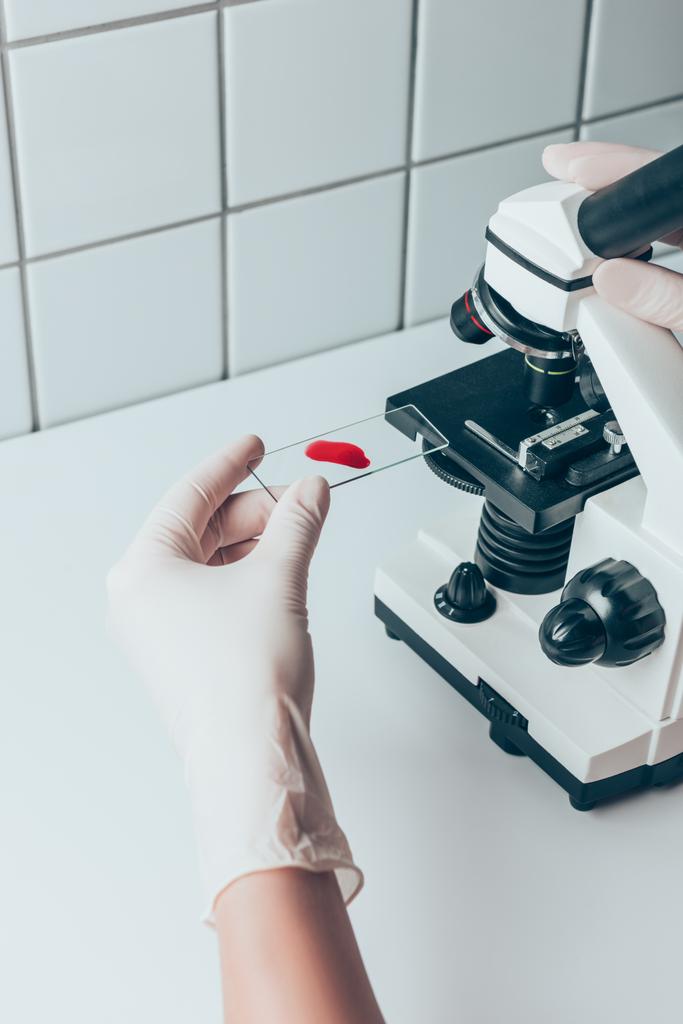 colpo ritagliato del medico che mette il campione di sangue nel microscopio per l'esame
 - Foto, immagini