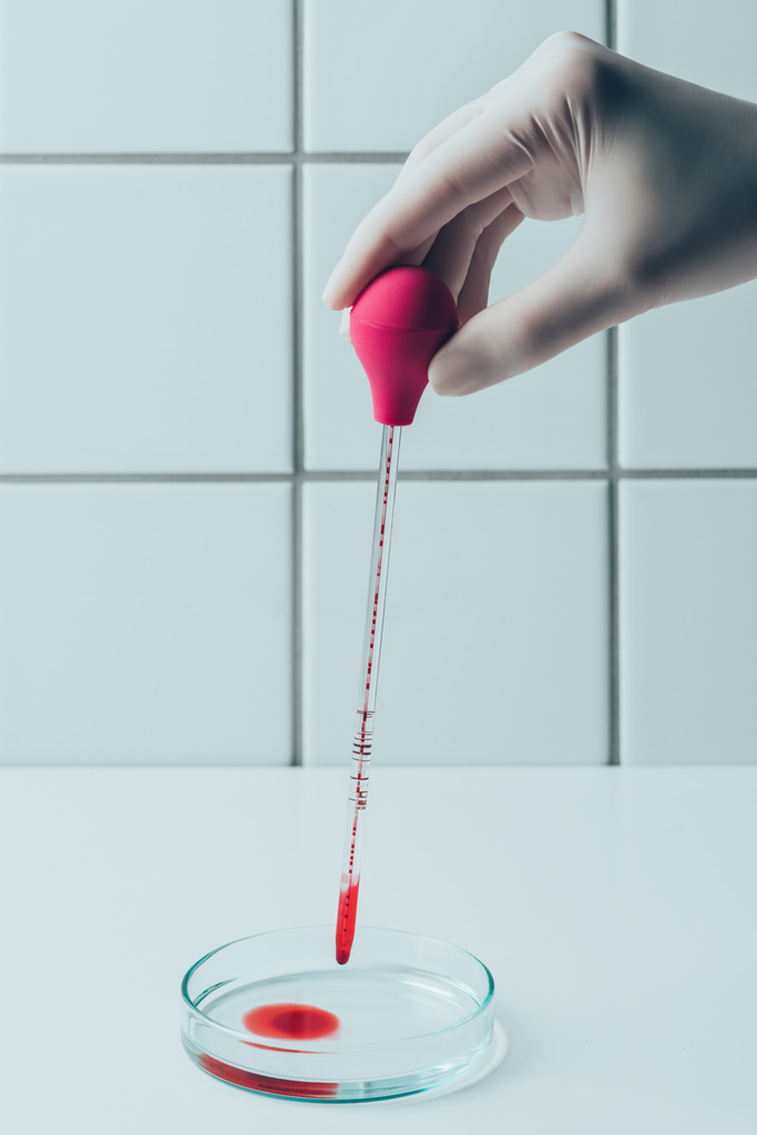 ペトリ皿に医者ピペットから注ぐ血のショットをトリミング - 写真・画像