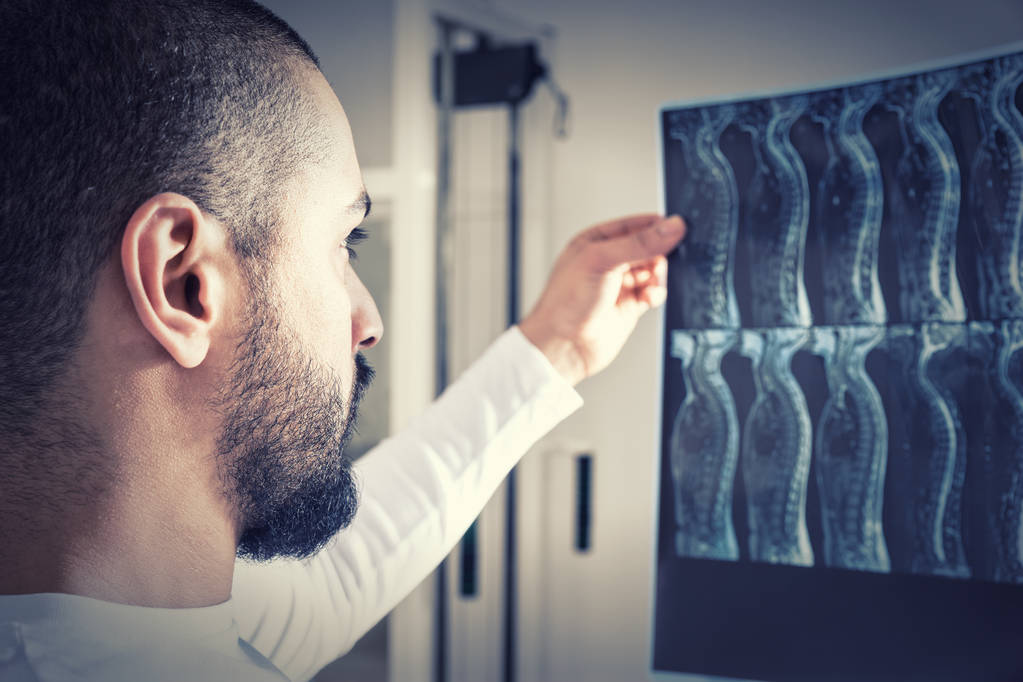 Zamknij się z męskiego fizjoterapeuty lub kręgarz lub lekarz patrząc na X-Ray Film kręgosłupa przed Light Box w klinice - Zdjęcie, obraz