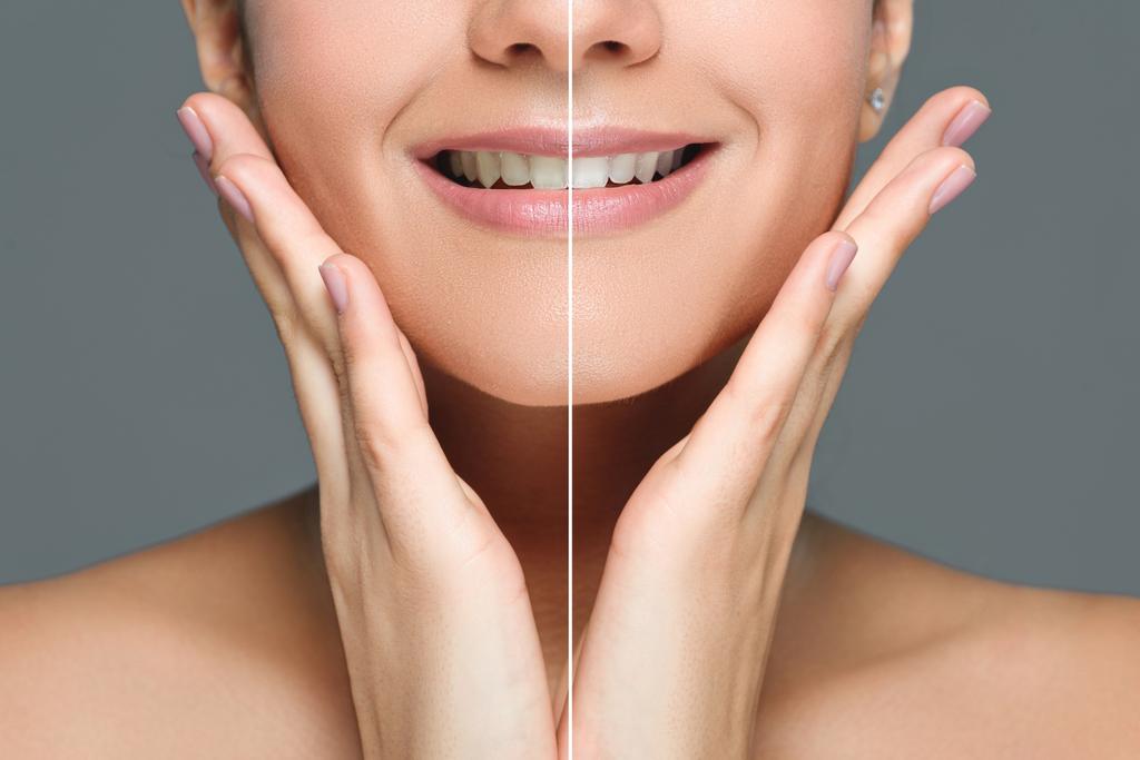 Częściowy widok uśmiechający się kobieta z białe zęby na białym tle na szary, koncepcja do wybielania zębów - Zdjęcie, obraz