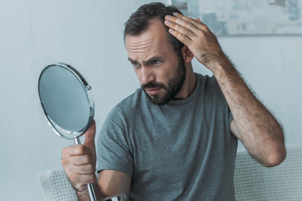 γενειοφόρος μέσης ηλικίας άνθρωπο με αλωπεκία κοιτάζοντας καθρέφτη, έννοια απώλεια μαλλιών  - Φωτογραφία, εικόνα