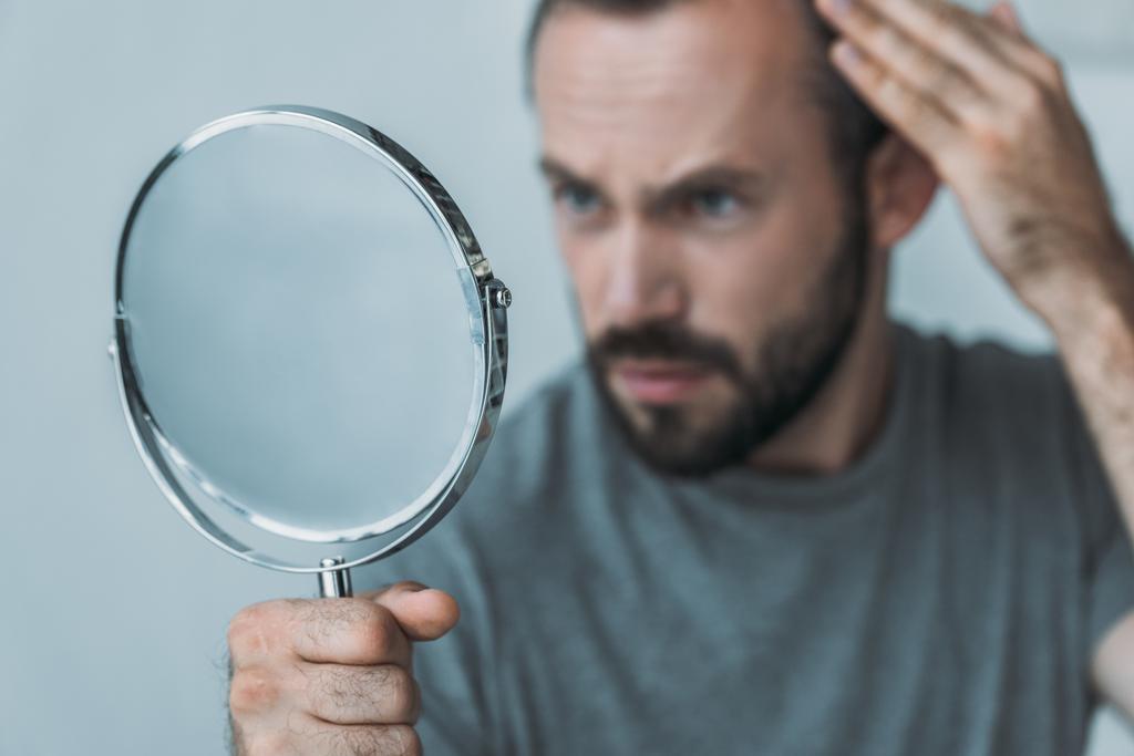 visão de perto do homem adulto médio barbudo com alopecia olhando para o espelho, conceito de perda de cabelo
  - Foto, Imagem