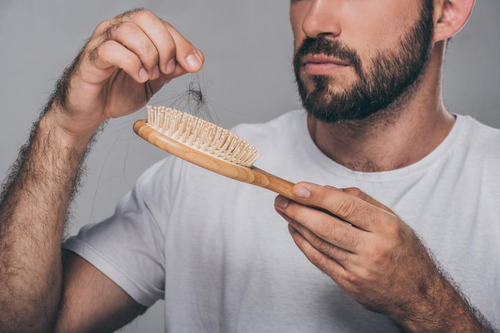 ritagliato colpo di uomo barbuto tenendo spazzola per capelli, concetto di perdita di capelli
 - Foto, immagini