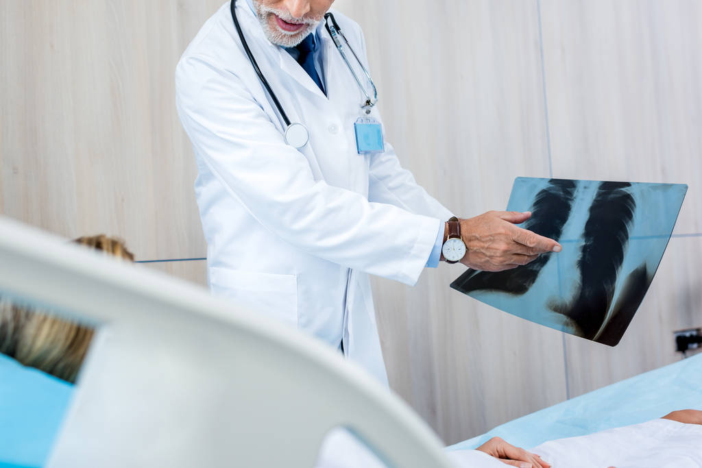 vista parcial del médico masculino que señala la imagen de rayos X al paciente femenino en la habitación del hospital
 - Foto, Imagen