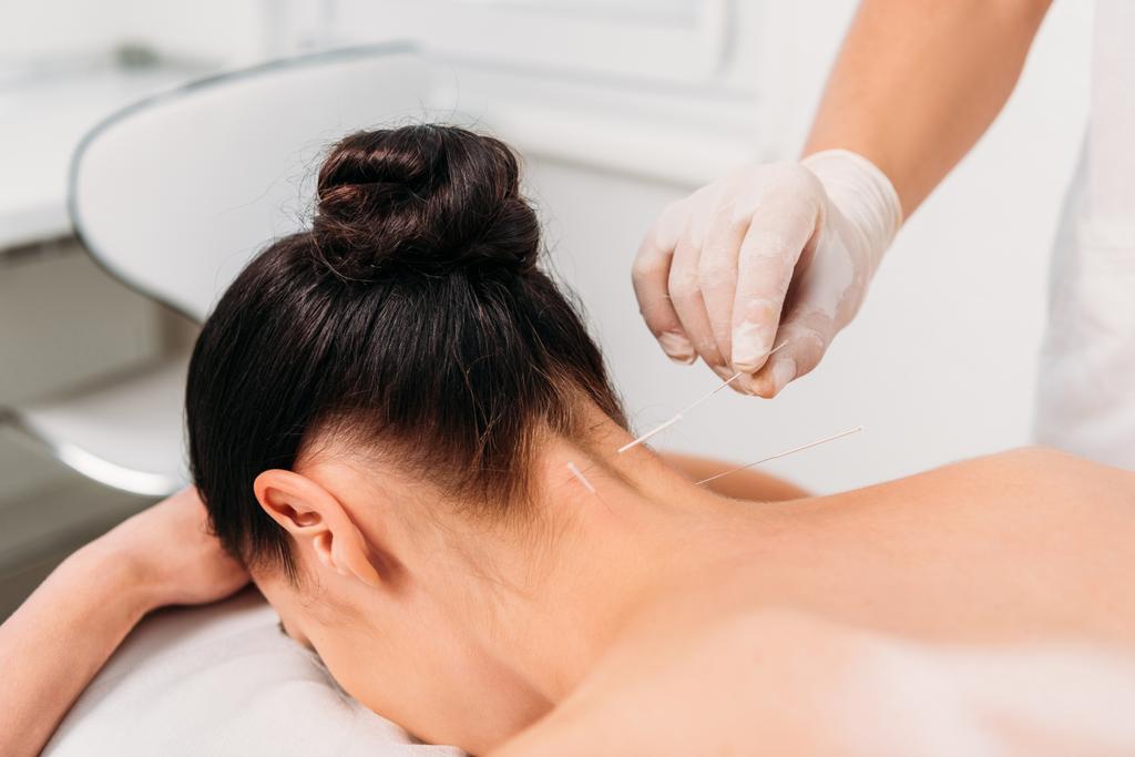 inyección recortada de cosmetólogo poner agujas en el cuerpo de las mujeres durante la terapia de acupuntura en el salón de spa
 - Foto, imagen