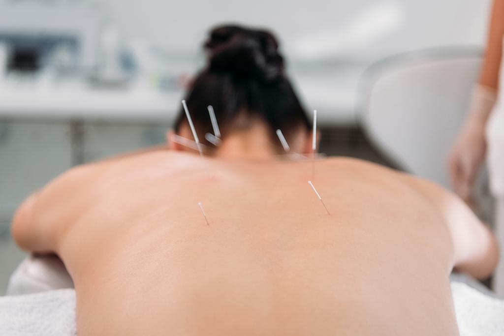 частичный взгляд женщины с иглами на спине, проходящей акупунктурную терапию в спа-салоне
 - Фото, изображение