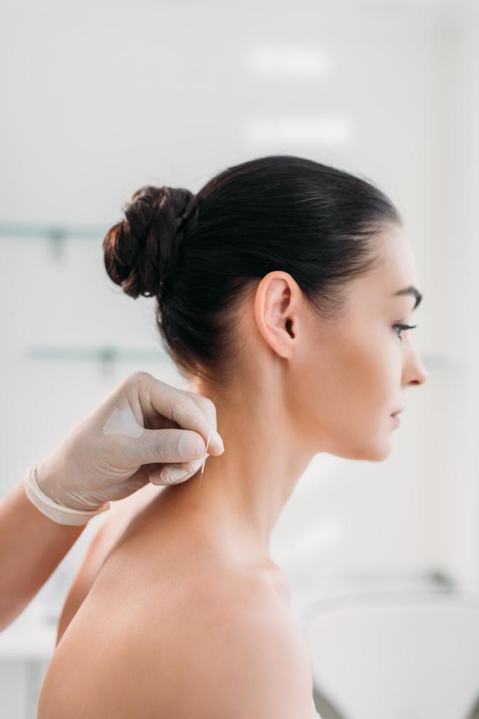 обрезанный снимок косметолога, втыкающего иглы в тело женщины во время иглоукалывания в салон красоты
 - Фото, изображение