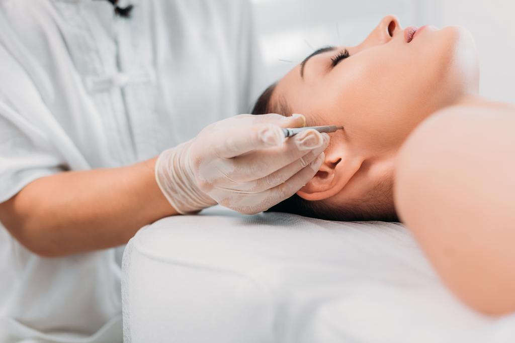 vista parcial del cosmetólogo colocando aguja en la cara de las mujeres durante la terapia de acupuntura en el salón de spa
 - Foto, Imagen