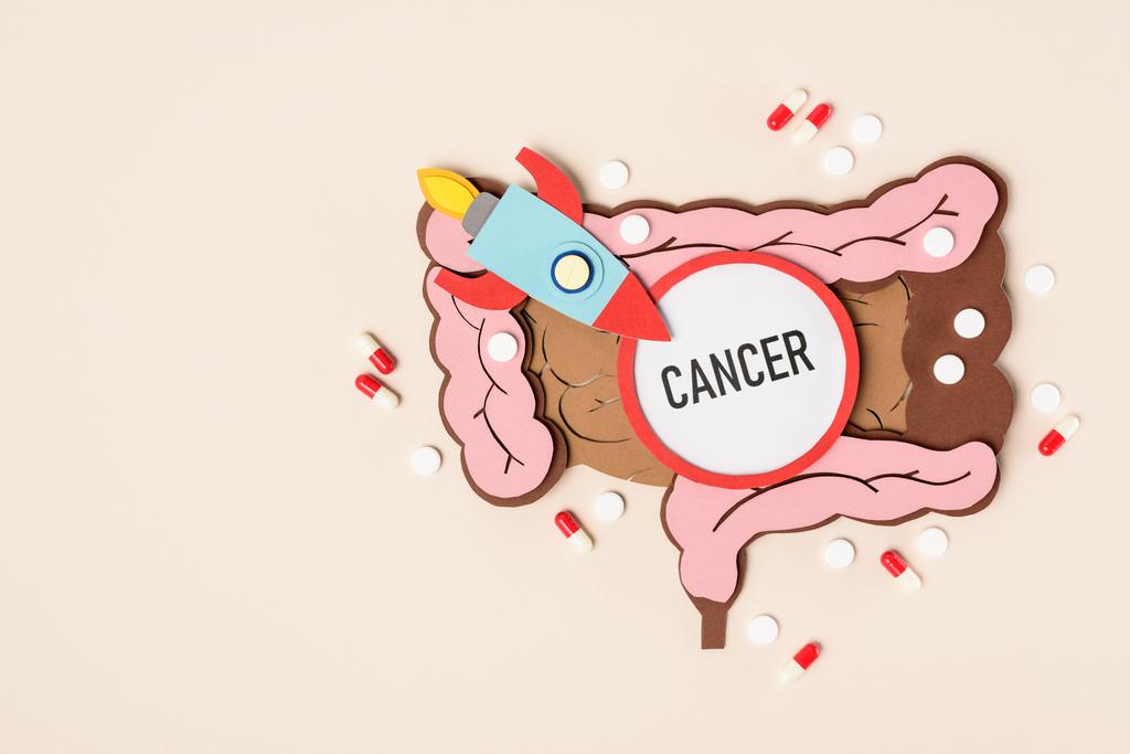 vista desde arriba del símbolo del cohete, intestino grueso humano, pastillas y cáncer de letras en beige
 - Foto, Imagen